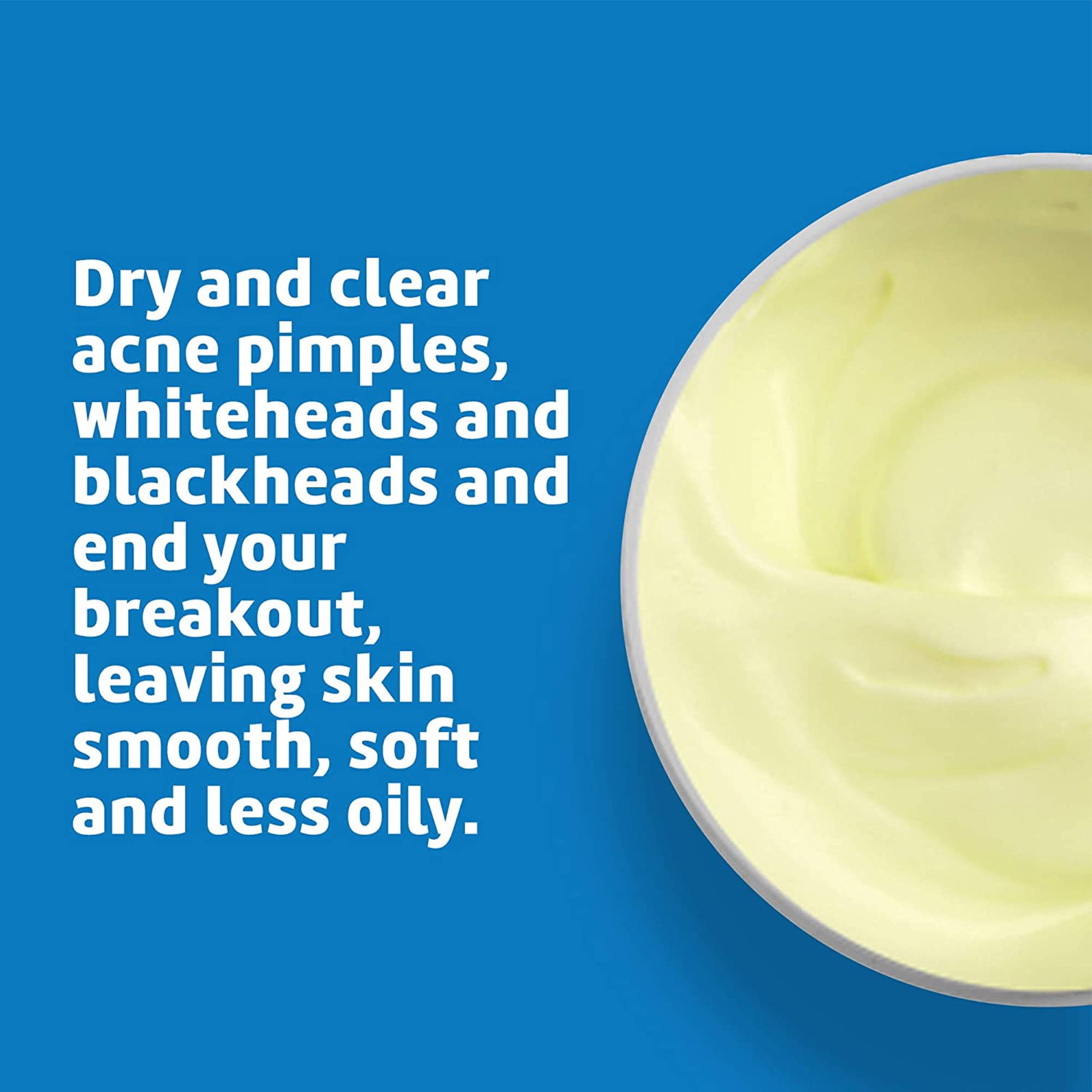 De La Cruz Acne Treatment Ointment - 10% Sulfur, Maximum Strength Clears Acne, Pimples, and Blackheads, 2.6 oz Jar