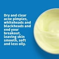 thumbnail image 5 of De La Cruz 10% Sulfur Acne Treatment, Clears Cystic Acne, Pimples, and Blackheads, 2.6 oz, 5 of 10