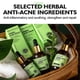 thumbnail image 2 of ZHAOCHENG Suero a base de hierbas para el acné, 17 ml, reparador de la piel contra el acné, tratamiento para el acné, esencia para eliminar las marcas del acné, 2 of 5