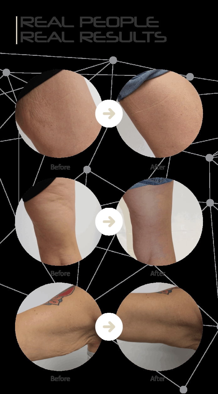 5-in-1 Body Sculpting Tool with Soothing Heat, Red Light, Vibration & Gentle Energy Pulses for a Toned Look on Arms, Legs, and Abdomen