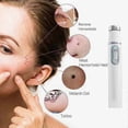 thumbnail image 4 of Blue Light Therapy Laser Pen for Spider Vein Removal Wrinkle and Acne Treatment, 4 of 5