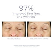 Derma E Anti-Wrinkle Retinol Renewal Cream with Retinol & Bakuchiol, Vegan Skin Care, 4 oz
