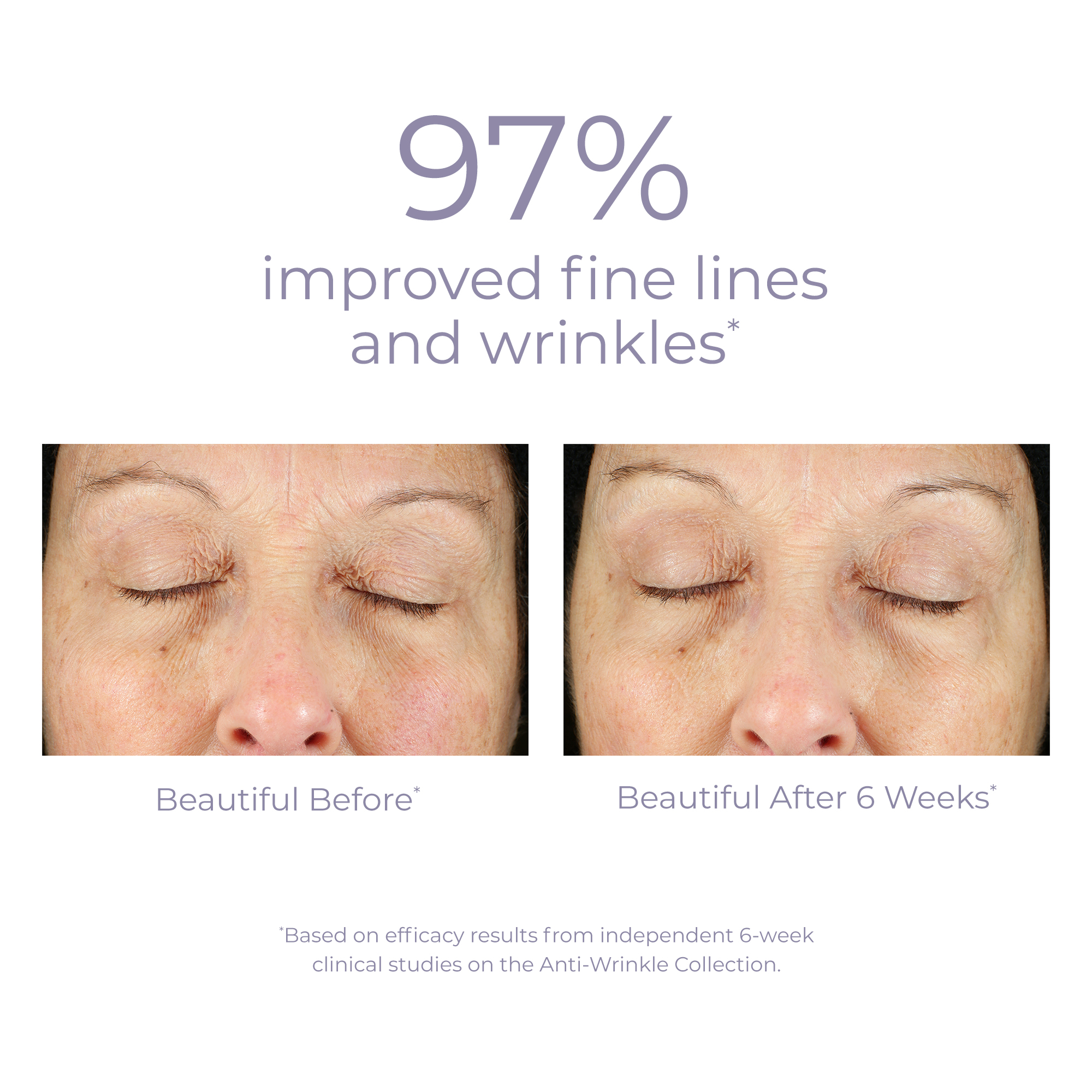 DERMA E Anti-Wrinkle Retinol Face Wash, Glycolic Acid Cleanser, Vegan Skin Care, 6 oz - image 5 of 10