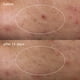 thumbnail image 4 of Parche líquido para el acné Dermalogica Deep, 15 ml, a base de azufre, 4 of 7