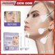 thumbnail image 2 of Jaysuing V-shaped Face Stick Lifting Firming Skin Sticking Facial Tightening Double Chin Lifting Facial Contouring Slim Face |, 2 of 5