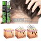 thumbnail image 5 of Spray para el crecimiento del cabello shaofei 10 ml, 5 of 5