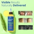 thumbnail image 3 of Rosemary, Tea Tree & Castor Oil, Hair Growth Oil Anti-dandruff Scalp Treatment, 6.7 fl oz, 3 of 8