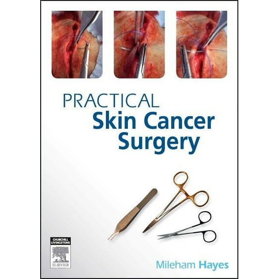 Practical Skin Cancer Surgery, (Paperback)