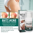 thumbnail image 3 of Butt Pimple Removing Cream, Reparacia de la Piel Penetracia rápida Butocks Pimple Cream Balance Oil for Home For Men Mujeres, 3 of 7