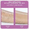 thumbnail image 5 of Hair Removal Physical Epilator, 5 of 5