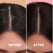 Just Nutritive Sensitive Scalp Psoriasis Shampoo, Restore Shine & Moisture, Sulfate Free 16oz