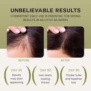 Lebanta Batana Oil for Hair Growth - 100% Pure Natural Blend with Organic Castor, Pumpkin Seed, Coconut and Rosemary Oil - Thicker, Stronger Scalp