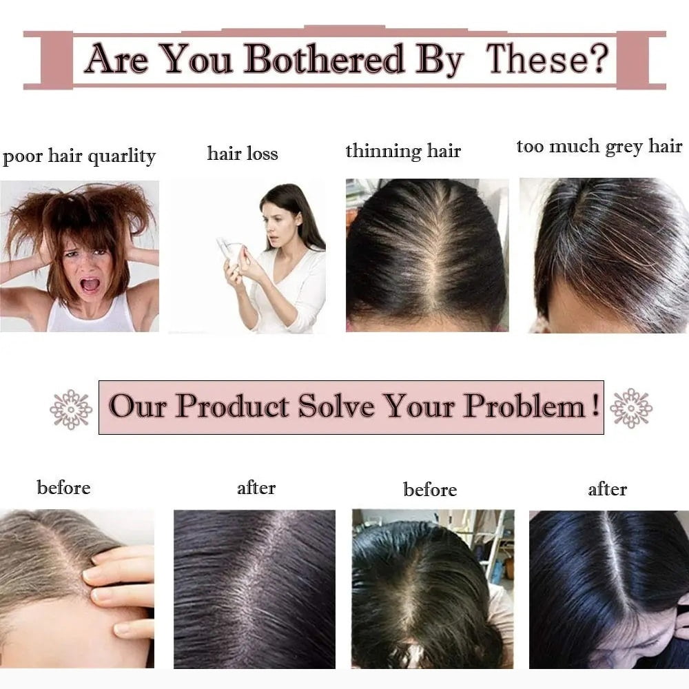 Hair Topper without Bangs Middle Part Straight Hair Topper Real Human Hair 15x16cm Silk Base Clip in Straight Hair Pieces for Women with Thinning Hair