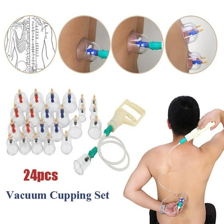 Mikasa China Cup - Anauto Cupping Set, Vacuum Cupping Set,24pcs U-shape Cups Chinese Vacuum Cupping Set Massage Therapy Suction Acupuncture
