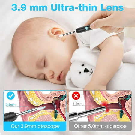 VITCOCO Ear Wax Removal, Wireless Ear Cleaner with 1920P Camera, Ear Wax Removal Tool with 6 LED Lights, 3.9mm Ear Camera Otoscope with 6 Spoons, Earwax Removal kit for iPhone, iPad, Android Phones