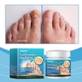 thumbnail image 3 of Para Tratamientos Onicomicosis El Cuidado La 20 G Las Uñas Los Pies, 3 of 9