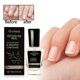 thumbnail image 1 of Onycholysis Nail Treatment & Strengthener, Onycholysis Nail Growth Conditioner, Onycholysis Heal & Restore Nails, Strengthen Weak Nails, 1 of 5
