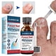 thumbnail image 1 of Nail Repair Solution Quick Absorption Nail Strengthening Liquid for Men Women, 1 of 5