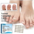 thumbnail image 4 of Nail Sticker Toenail Correction Nail Groove Inlay Nail Co, 4 of 5