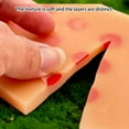 thumbnail image 4 of Giaone Intradermal Injection Model Teaching Tool For Intradermal Injection Skill, 4 of 9