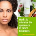 thumbnail image 3 of Goldfaden MD Detox Hydrating Gel - BHA Skin Balancing Moisturizer, 3 of 5
