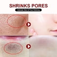 thumbnail image 2 of Crema retráctil de poros con ácido salicílico, eliminación rápida de poros grandes, eliminación de puntos negros, estiramiento de la cara, piel suave, producto coreano para el cuidado, 2 of 5
