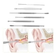 thumbnail image 3 of Stainless Steel Ear Pick Set Curette Ear Wax Remover Spiral Spring Earpick Ear Cleaner, 3 of 4
