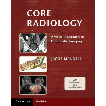 Core Radiology : A Visual Approach to Diagnostic Imaging