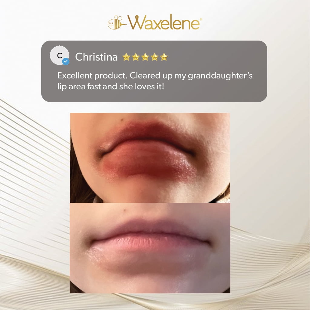 Waxelene - Multi-Purpose Ointment - Lip Tube 5 Piece