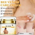 thumbnail image 1 of Removal And Removal And Unisex Pore Vacuum, 1 of 8