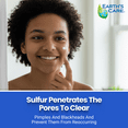 thumbnail image 3 of Earth's Care Acne Spot Treatment Sulfur Cream - Maximum Strength - 0.97 oz Tube, 3 of 9