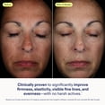 thumbnail image 3 of Sérum facial Skinfix Exo + Ectoin Intensive Repair Baume 30 ml, 3 of 9