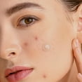 thumbnail image 4 of Hitworker 432pcs Hydrocolloid Pimple Patches - Salicylic Acid Acne Patches for Sensitive Skin, 4 of 4