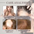 thumbnail image 2 of Jaysuing Coconut Hair Oil Moisturizes And Nutritivates Thick Hair Strengthens Thick Hair Massage Scalp Oil Hair Loss Treatments, 2 of 3