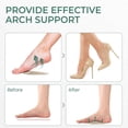 thumbnail image 4 of Welnove 4 Pairs Arch Support Shoe Insoles for Flat Feet, Gel Arch Inserts for Plantar Fasciitis, Adhesive Arch Pad for Relieve Pressure and Feet Pain, 4 of 9