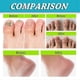 thumbnail image 3 of 3 piezas de espray para pies y uñas, cuidado natural y potente para los pies, 3 of 4