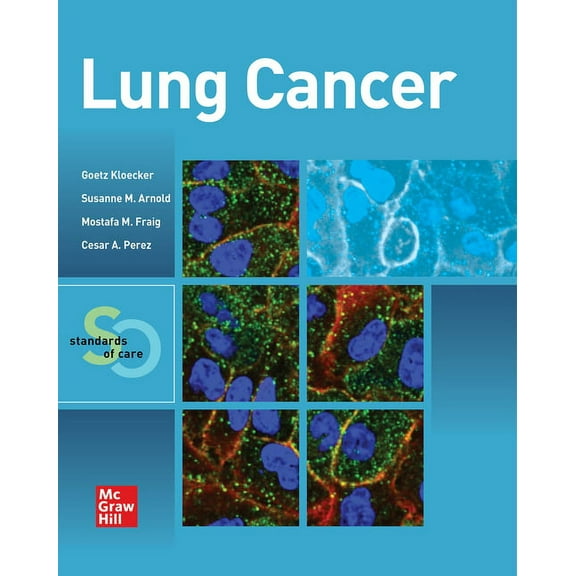 Lung Cancer: Standards of Care, (Paperback)