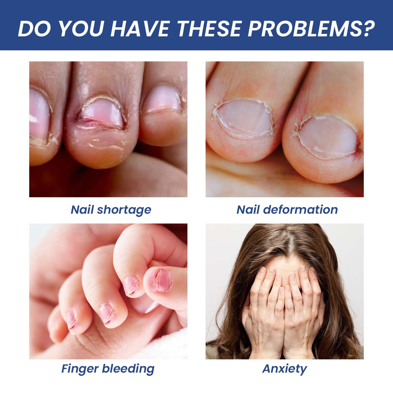 I used to bite my fingernails a lot. Now though I have stopped, my nails  grow unevenly and look disgusting once fully grown. Please can you give  tips? - Quora