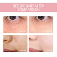 thumbnail image 3 of Ganfancp Serum Corrector Oscuro /Niacin Serum 70 Serum Facial para Marcas Hiperpigmentación y Unificar Tono Piel 30Ml Ofertas Flash Liquidación 1X Esencia Reparadora de Manchas 30Ml, 3 of 7
