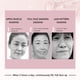 thumbnail image 4 of Fiudx Correa para Levantar La Barbilla, Reductor de Papada Por Infrarrojos Lejanos, Banda Ajustable para Moldear El Rostro, Diseño Cómodo y Portátil, Uso Diario, Esencial de Belleza Femenina, Materia, 4 of 6