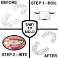 thumbnail image 3 of Small Mouth Guard for Women – Comfortable, Custom Fit, Non-Bulky, Moldable – (4) Teeth Grinding Guards & Case – Perfect Mouthguard for a Woman, Size – Small, 3 of 13