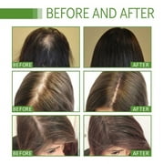 Hair Growth Oil, Hair Regrowth Essence, Hair Regrowth Treatment Advanced, Hair Regrowth Plant Extract Oil for Women Men (3pcs)