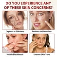 thumbnail image 2 of Rice Exfoliating Ampoule Set, Gentle Peel & Pore Minimizing & Deep Hydration, Exfoliant for All Skin Types (White+Black), 2 of 11