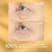 StriVectin Hyperlift Eye™ Instant Eye Fix, 0.34 fl oz