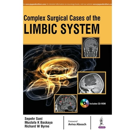UPC: 9789386261441 | Complex Surgical Cases of the Limbic System (Hardcover)