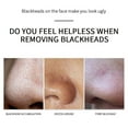 Larmly Blackhead Removal Nasal Tear Off Nasal Strip Blackheads Closed
