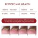 thumbnail image 4 of Jaysuing nail care oil soft nail polish repair ingrown nail thickening type onychomycosis care essence oil, 4 of 5
