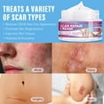 thumbnail image 2 of Vogsig Scar Cream - Soften and Hydrate - For New and Old Scar - Prevents Pigmentation 50g/1.7oz, 2 of 9
