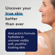 AmLactin Intensive Healing Body Cream – 12 oz Tub – 2-in-1 Exfoliator and Moisturizer for Dry Skin with 15% Lactic Acid and Ceramides for 24-Hour Moisturization