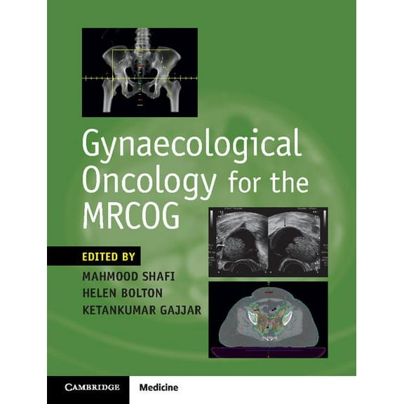 Gynaecological Oncology for the Mrcog, (Paperback)